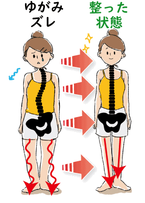 身体のゆがみと整った姿勢を対比した概念イラスト
