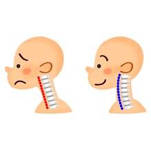 首の姿勢を比較したイラスト
