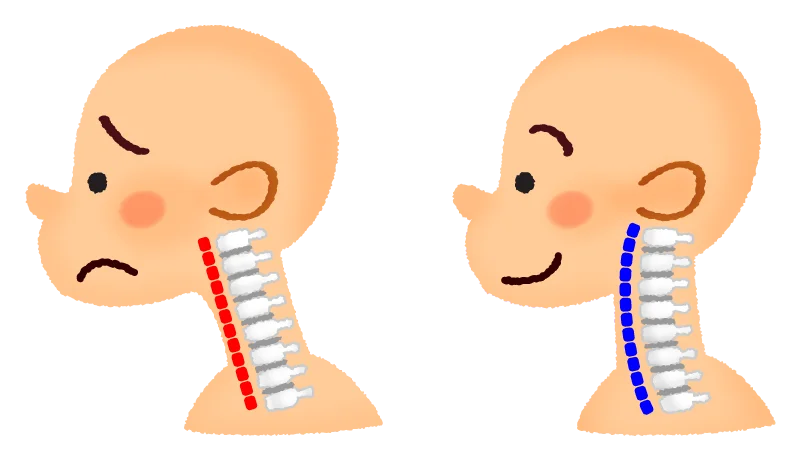 首のカーブと頭の位置を比較したイラスト